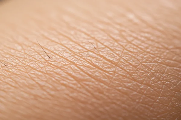 Waxing Pain: 2026 Comfort Revolution Strategies
